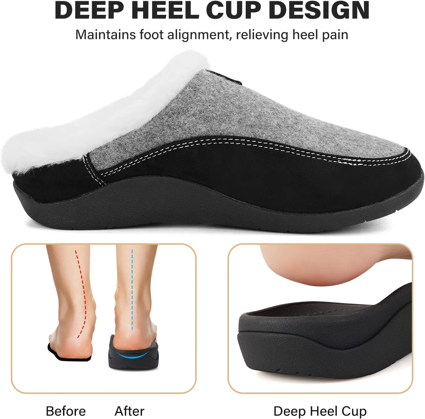 V.Step Orthopedic Slipper with Arch Support, Orthotic Slipper for Plantar Fasciitis Pain Relief, Men & Women Indoor/Outdoor Anti-Skid Shoe