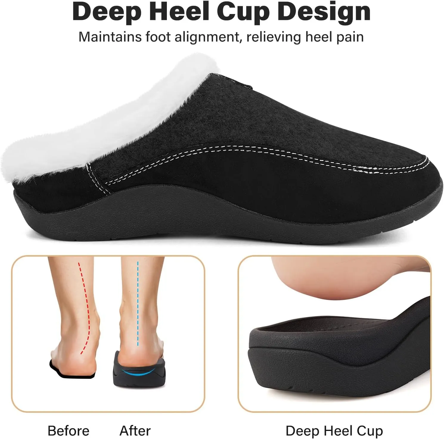 V.Step Orthopedic Slipper with Arch Support, Orthotic Slipper for Plantar Fasciitis Pain Relief, Men & Women Indoor/Outdoor Anti-Skid Shoe
